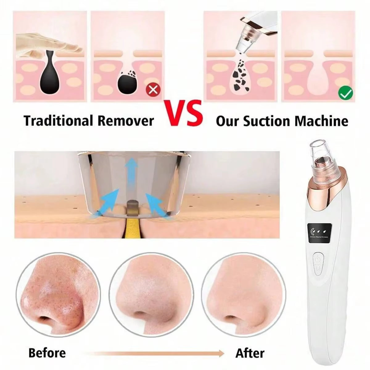 2026 Facial Pore Cleaner, 5 Suction Power Blackhead Remover Pore Vacuum - USB Rechargeable Facial Pore Cleaner Kit