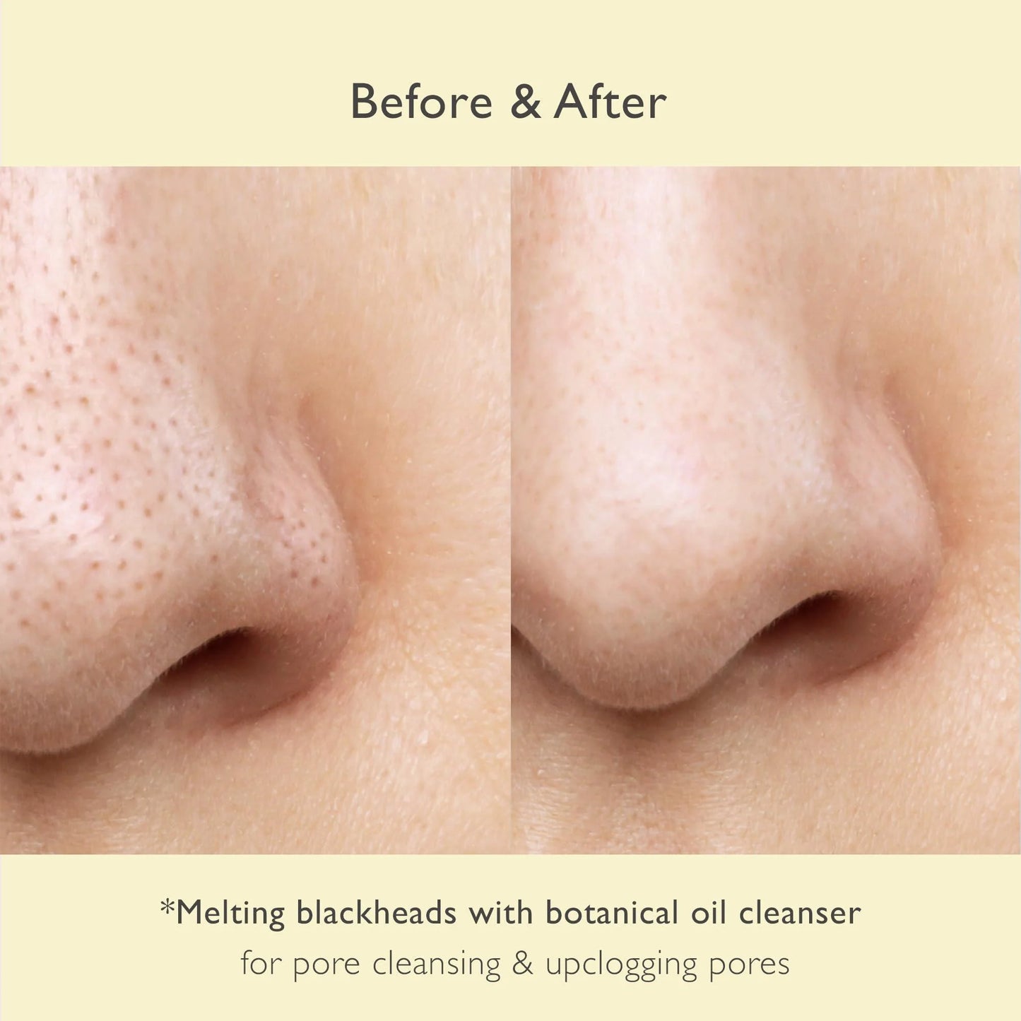Makeup Cleansing Oil 6.76 Fl Oz Pore Blackheads Cleansing Olive Oil Tea Tree